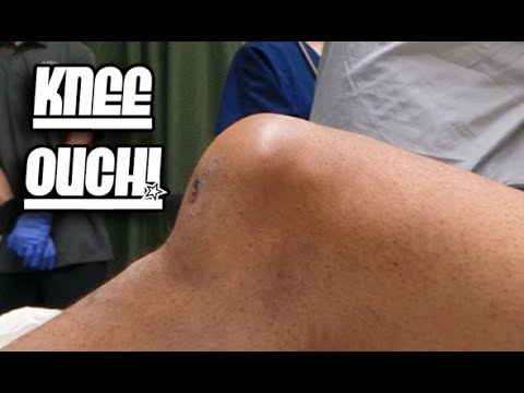 Dislocated Knee or Patella