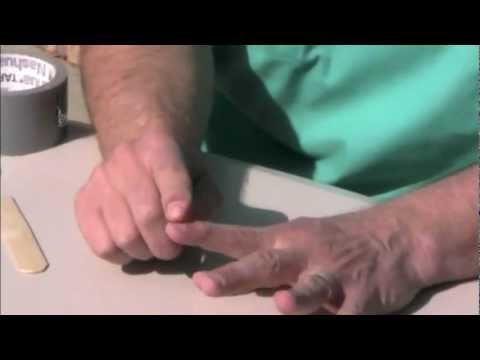 How to Splint Different Finger Injuries
