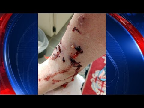Raccoon attacks Tampa woman