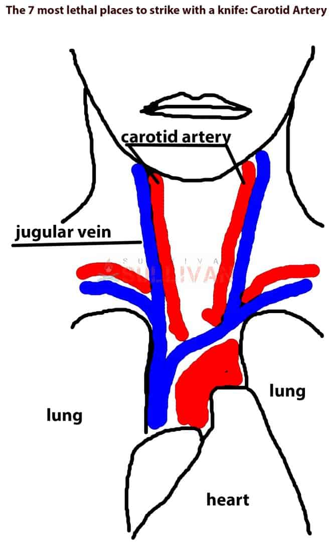 carotid jugular access